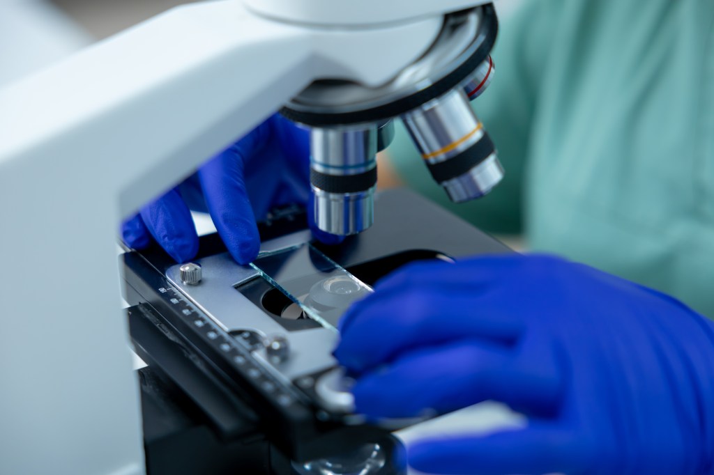 Scientists studied how cancer spreads. Then they found an unexpected ally