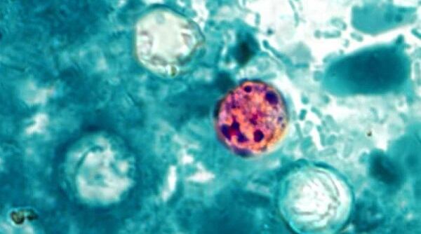 Reportan segundo caso de cyclosporiasis vinculado a brote en Clark County