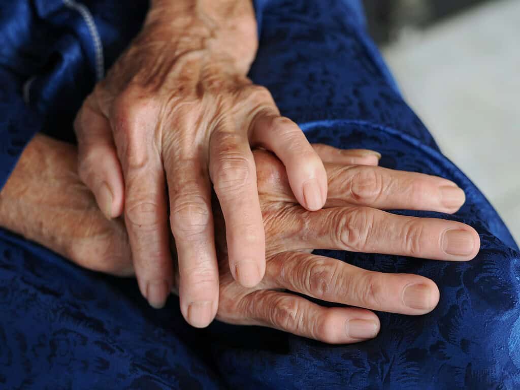 How long could humans live if we cured aging? People might live to 200 years before DNA damage kills them