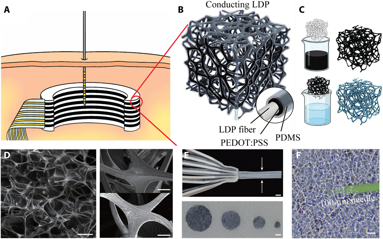 Soft outlet placed beneath the skin could help recharge implanted devices