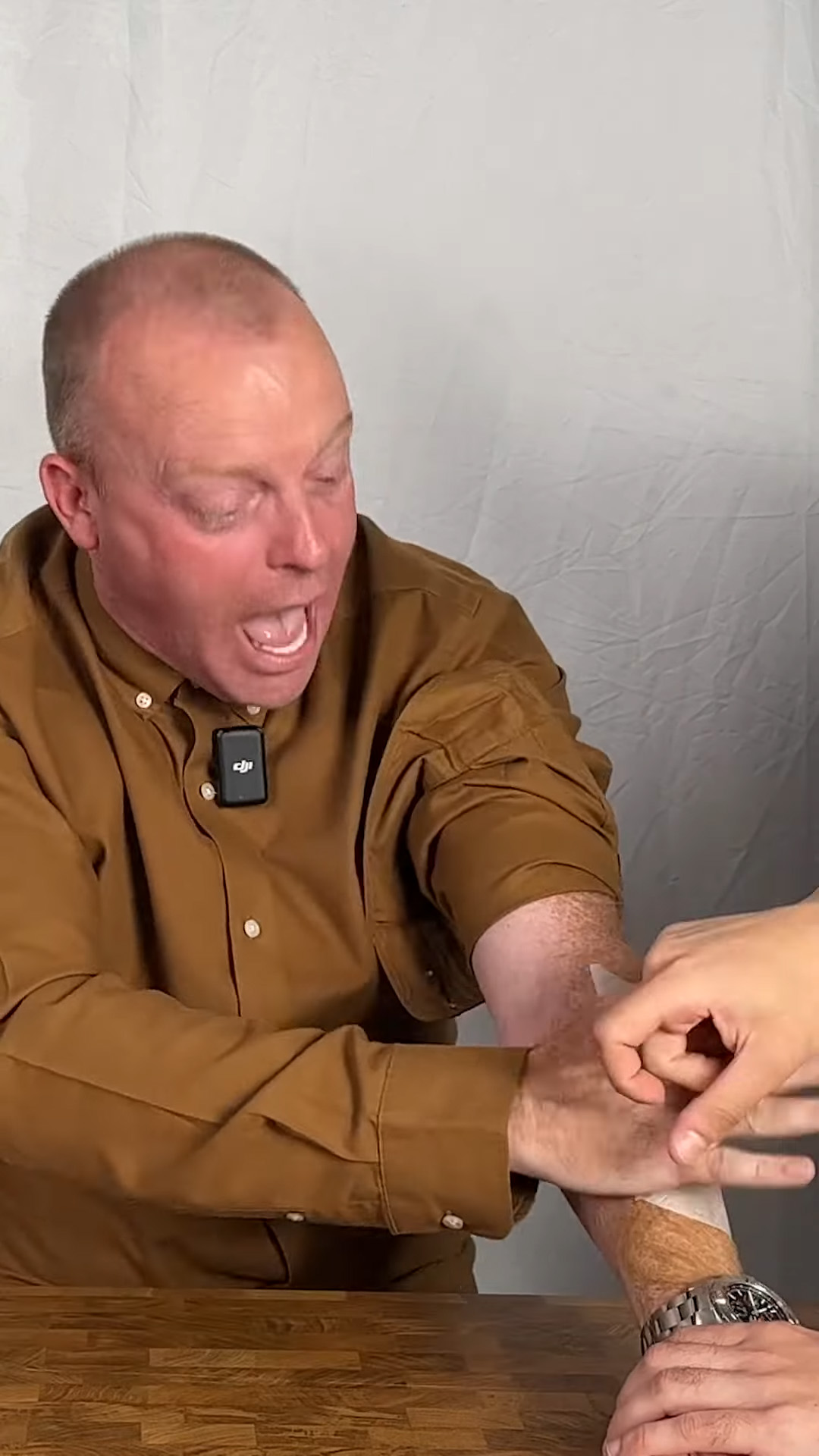 Reaction to a painful arm waxing candy challenge