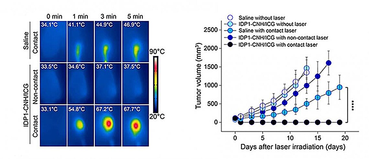 Combined nanoparticle and internal laser method could make cancer therapy less invasive