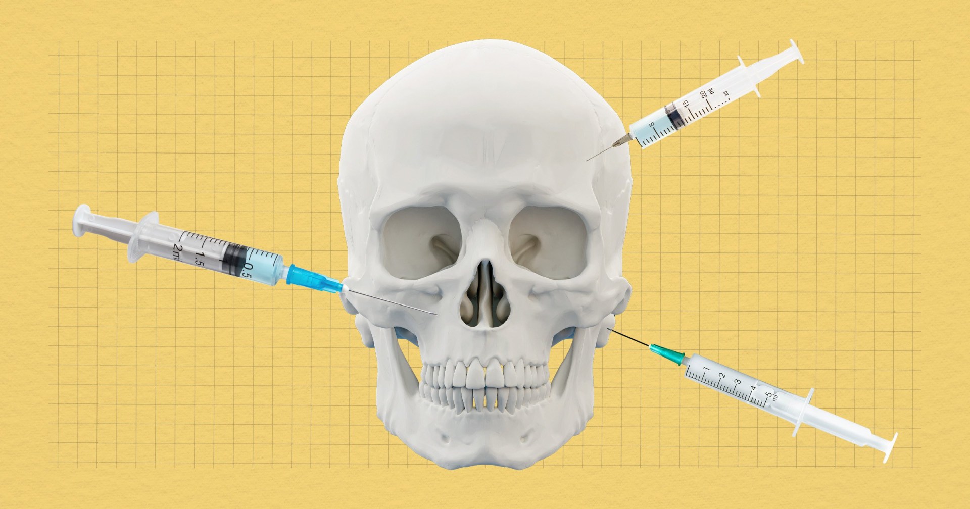 Cadaver collagen has hit the beauty industry — and yes, it’s from dead bodies