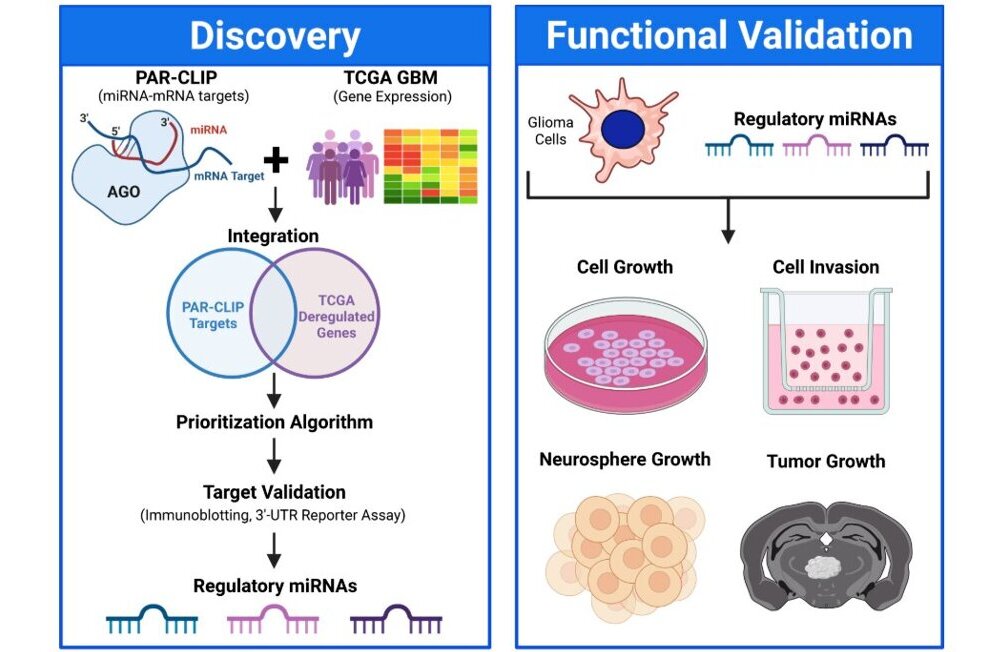 Brain-penetrating nanoparticles, ultrasound and microbubbles show promise in treating glioblastoma