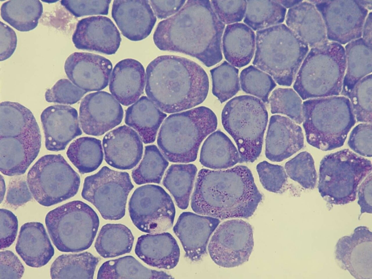 Two cellular components unlock maturation in human leukemia cells, study finds