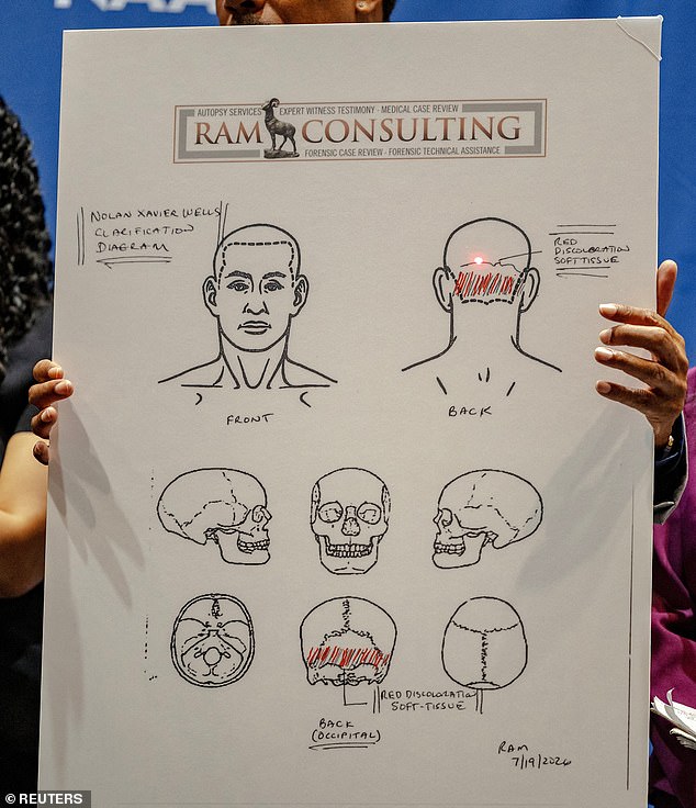 Crump displayed banner-sized copies of the autopsy report during Wednesday's conference, including this page, which revealed that forensic pathologist Dr Roger Mitchell found 'red discoloration' on the back of the teenager's head