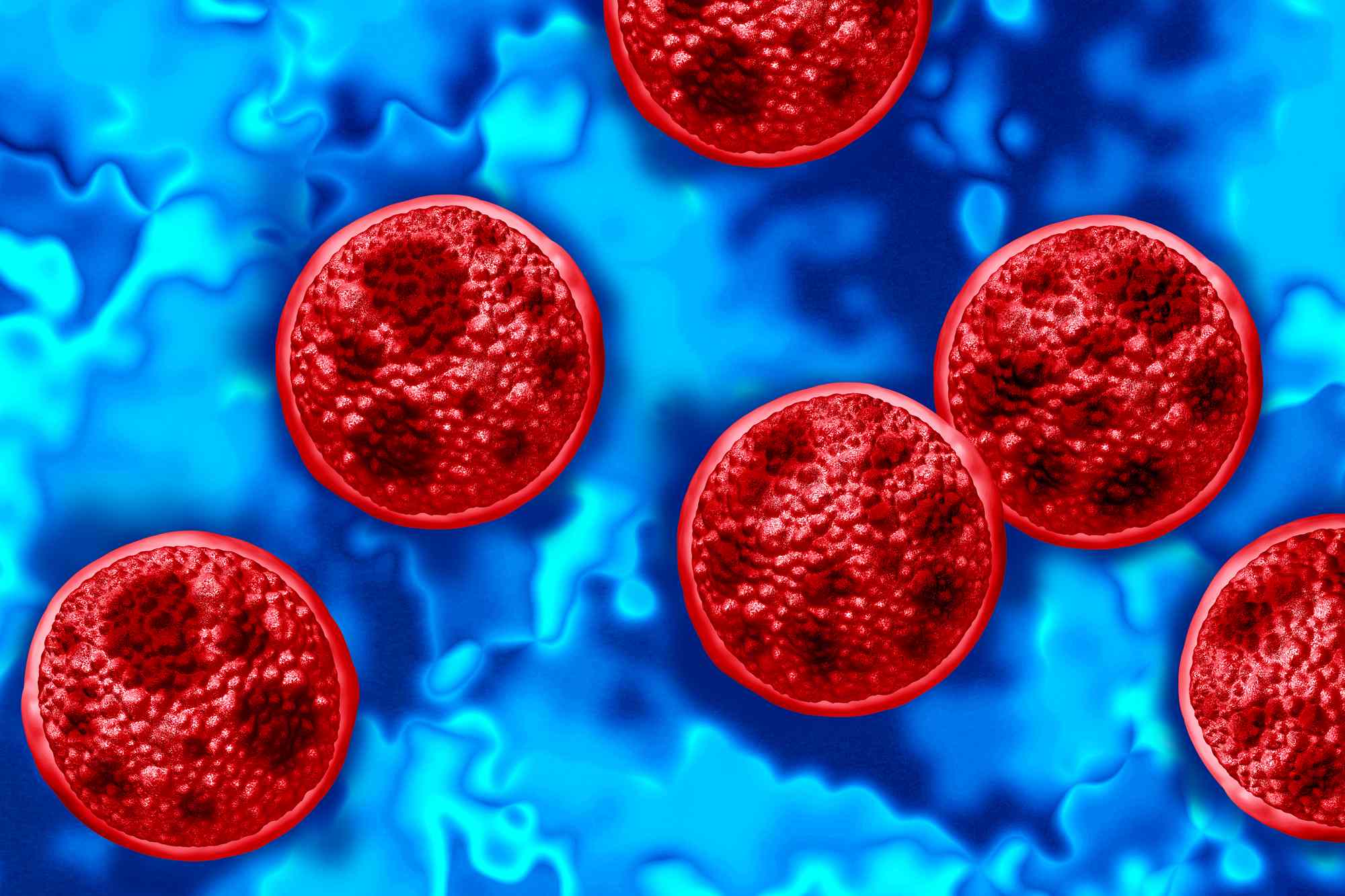 CDC reports 11,500 suspected cases of cyclosporiasis in 41 states while RFK Jr. says outbreak is 'under control'