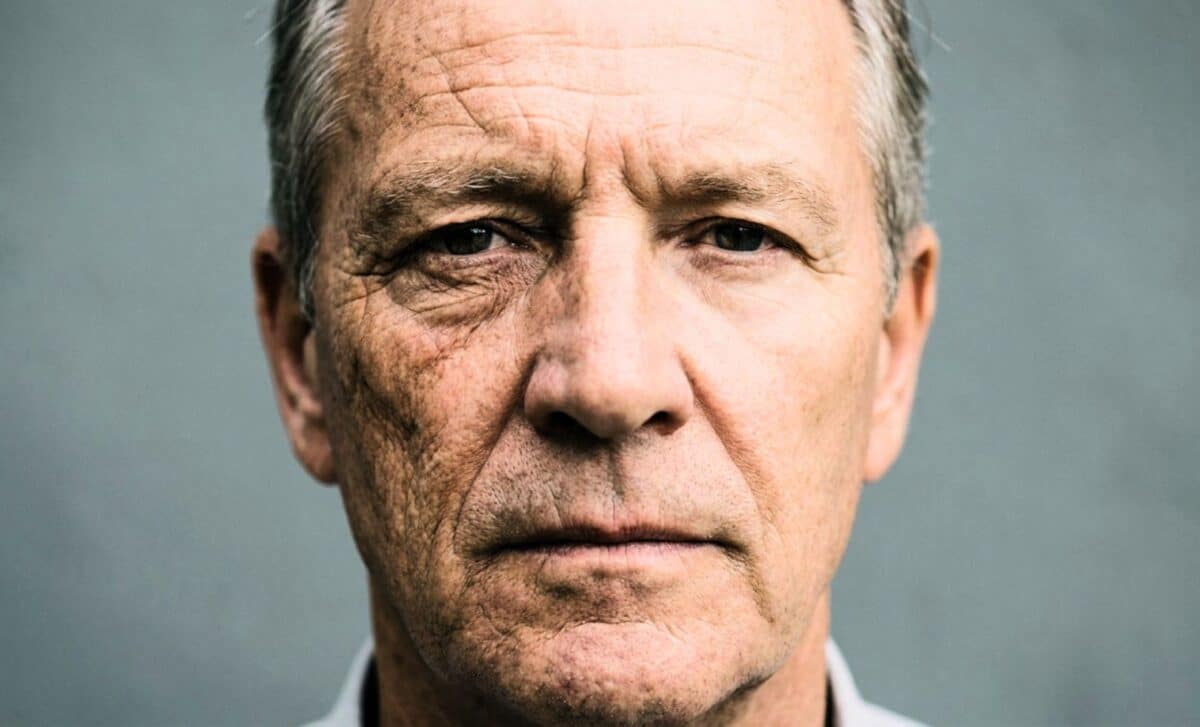 After 28 years driving with closed windows, one side of this man’s face looked decades older