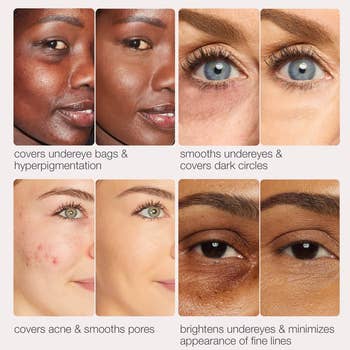 Collage of close-up images showing concealer effects on different skin areas: under-eye, acne, and fine lines, promoting a dual-use concealer product