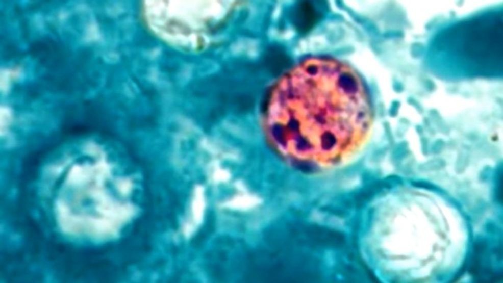 Boone County outpacing Missouri in cyclosporiasis cases as investigation continues