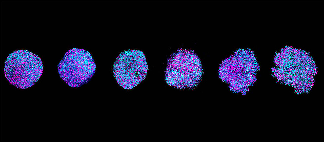 Even a slight overproduction of tubulin can tip the balance of cellular health, study shows