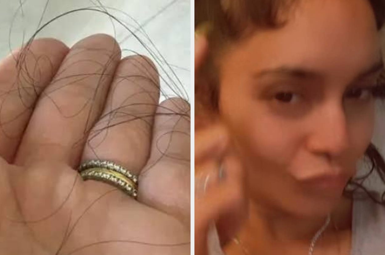 Four months after revealing her hair loss, Vanessa Hudgens shared an update