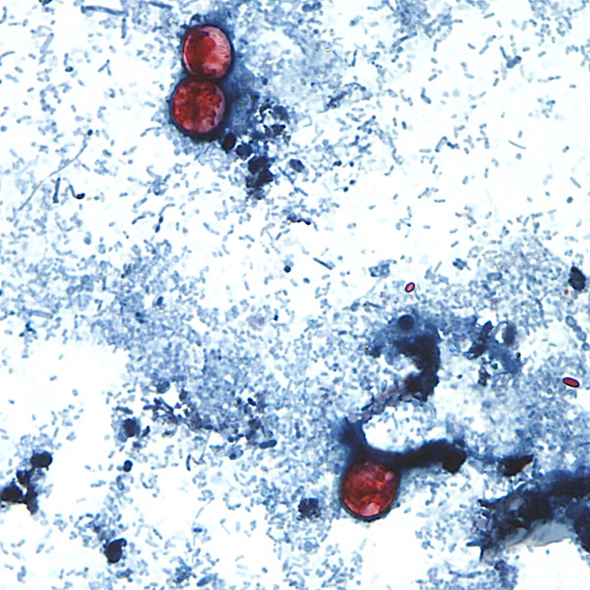 How a feces parasite landed in our food supply