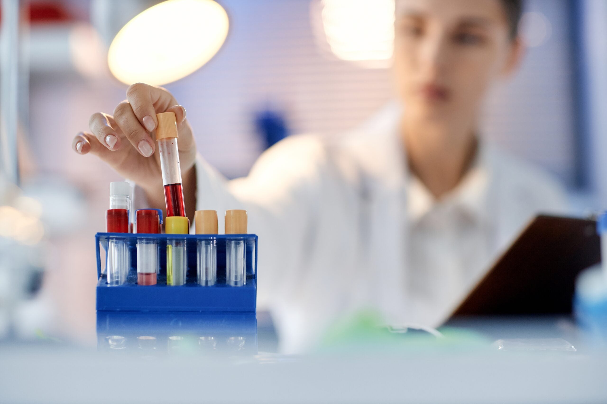 New blood test successfully detects 90% of early-stage pancreatic cancers