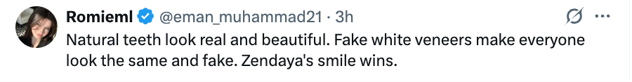 Tweet praising Zendaya's natural smile over fake veneers
