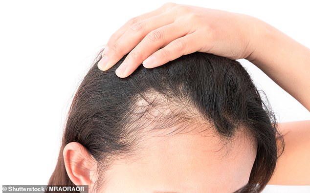 Hundreds of users have been reporting hair loss to regulators in the United States and UK but new research on 50,000 people now appears to firm up the link.