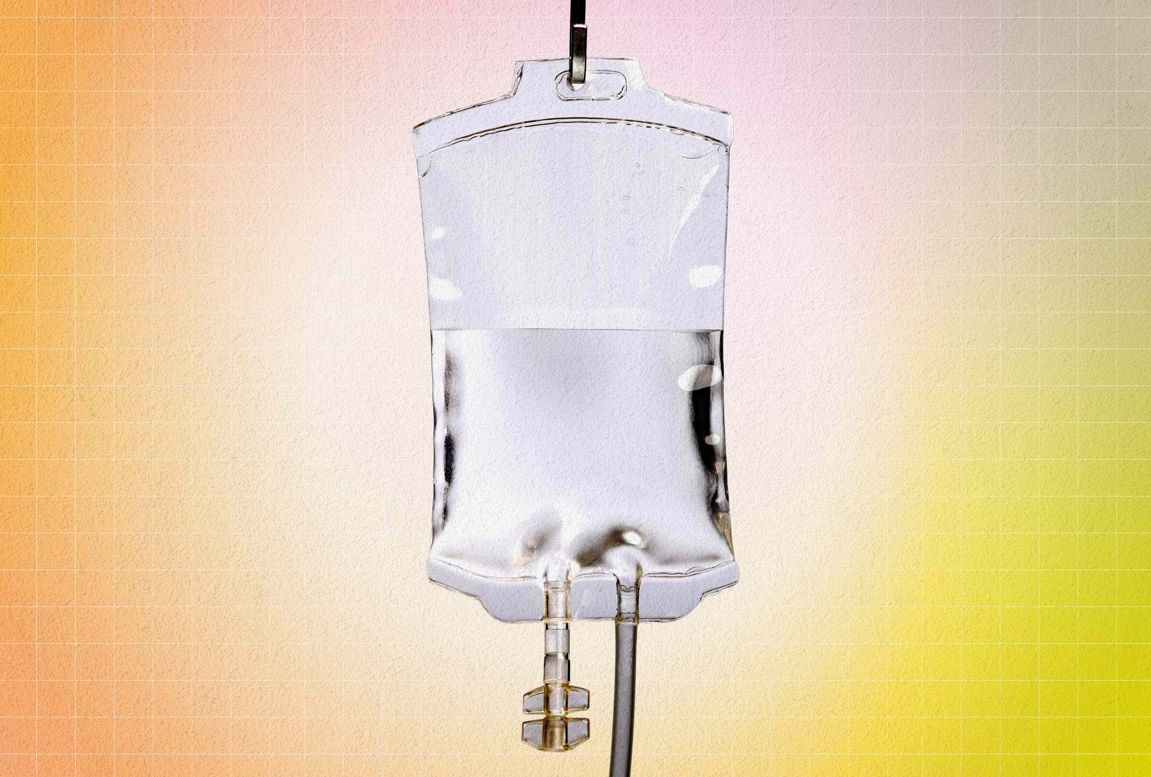 I tried the NAD+ IV infusion—here’s what you should know