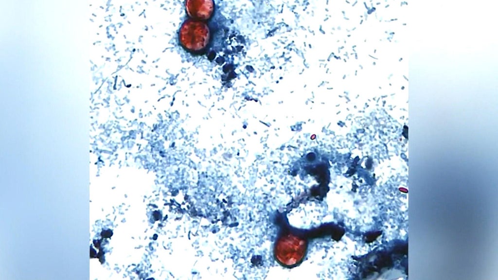 Research being done in Colorado examines how climate change may reshape disease risk, spread