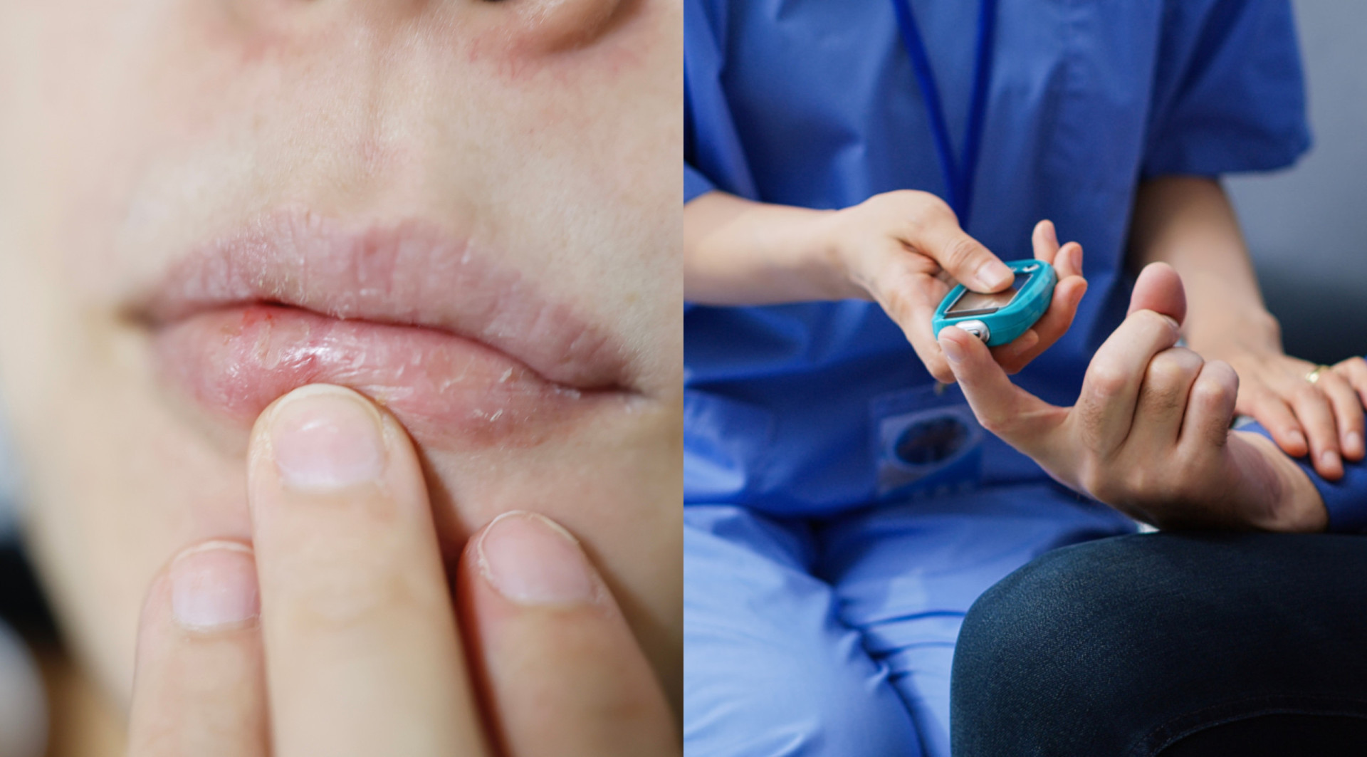 Sjögren's syndrome: can it be the cause of your dry eyes and mouth?