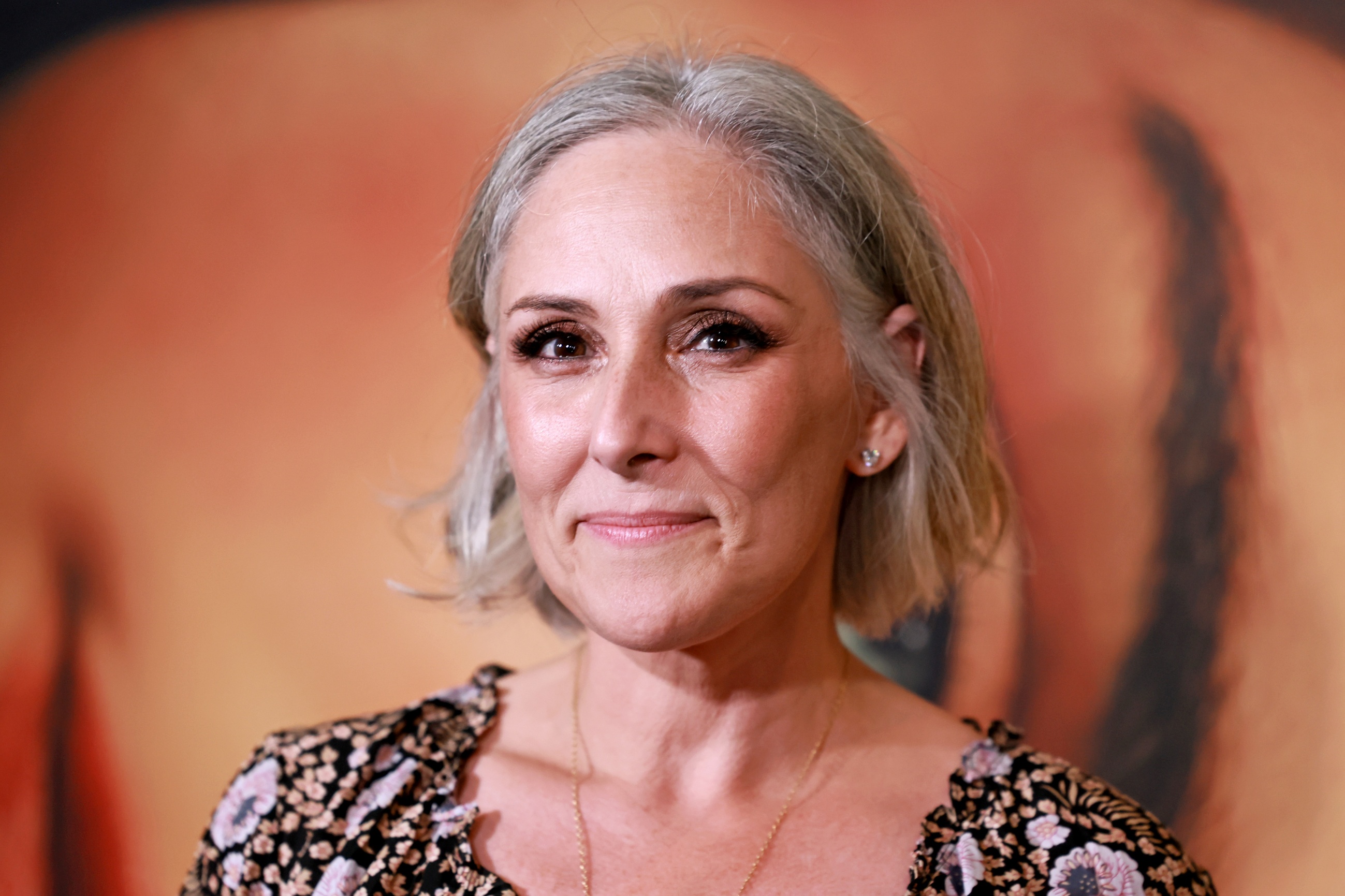 Ricki Lake marks two years since facelift with candid before-and-after photos