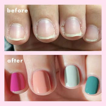 before and after using the serum