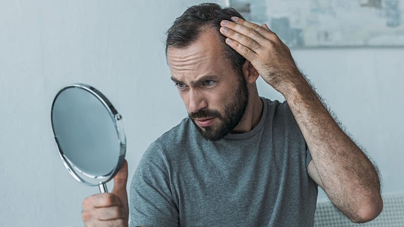 GLP-1 weight-loss drugs linked to low but real risk of hair loss, study finds