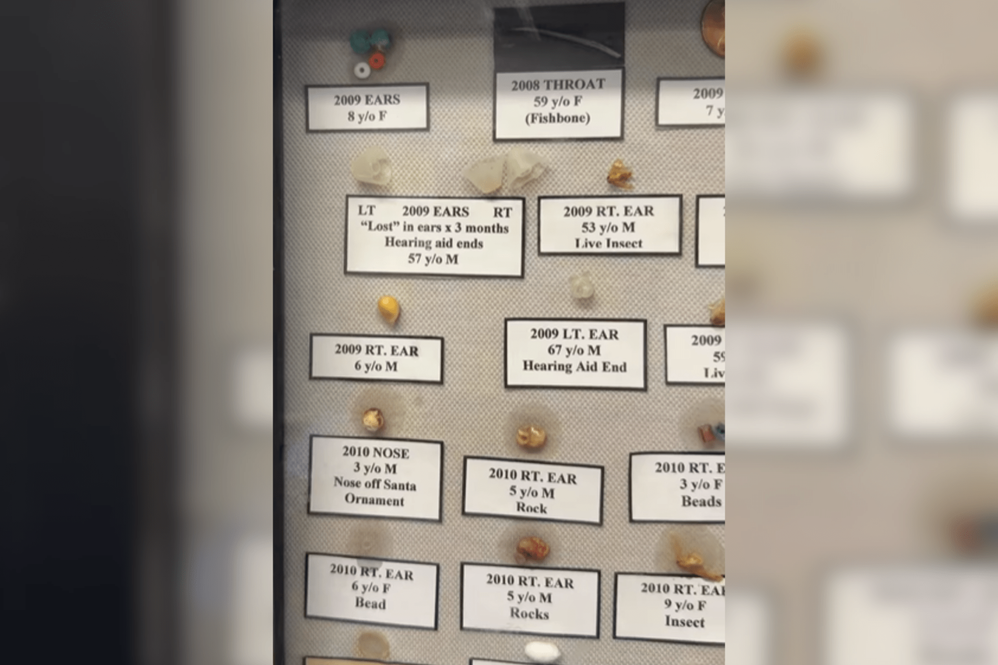 Woman horrified by what she spots at ENT’s office: 'New fear unlocked'