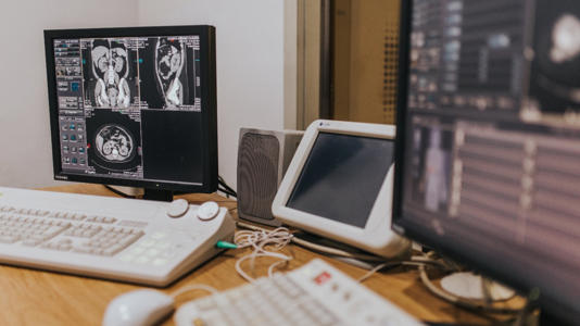 MSN: A hospital AI vendor was hacked, exposing the