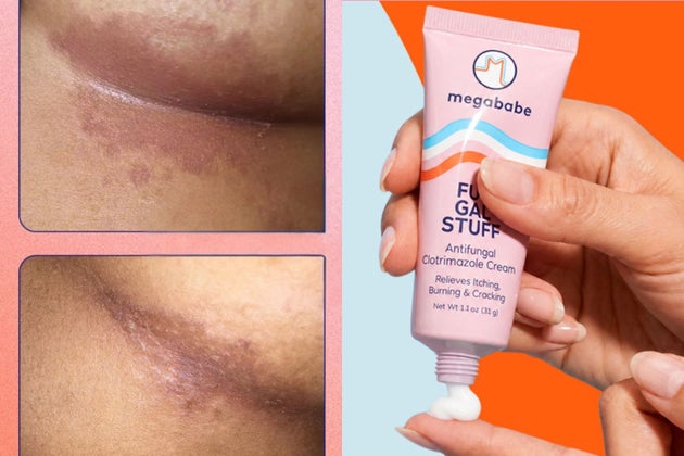 Your sweaty, rashy skin folds are no match for this full-body cream