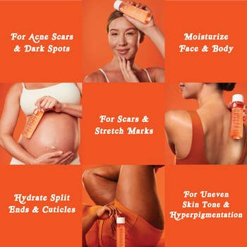 Collage of a woman using skincare oil, highlighting benefits for acne scars, moisturization, skincare for scars, and more. Product held in each image