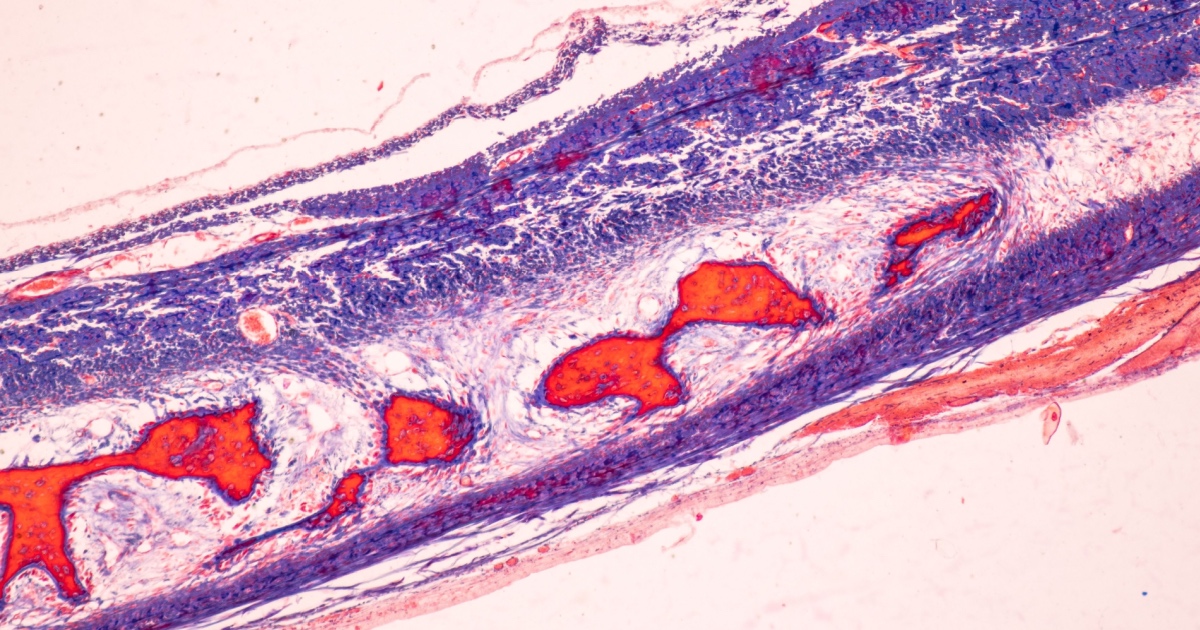 Scientists just found a secret switch in our bodies to turn on fat burning and turn off fat storage
