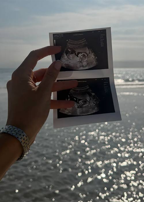 Pic: Louise Cooney/Instagram