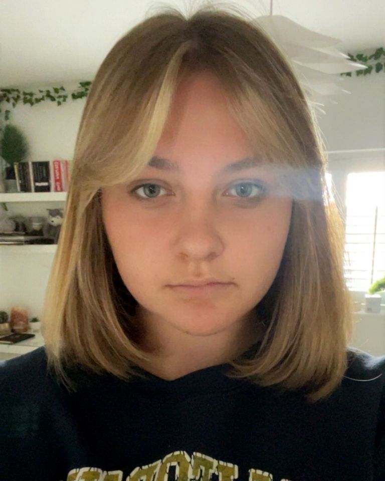 Tilly Phillips, now 16, was 15 when she underwent the conscious craniotomy procedure at Alder Hey Children's Hospital in Liverpool.