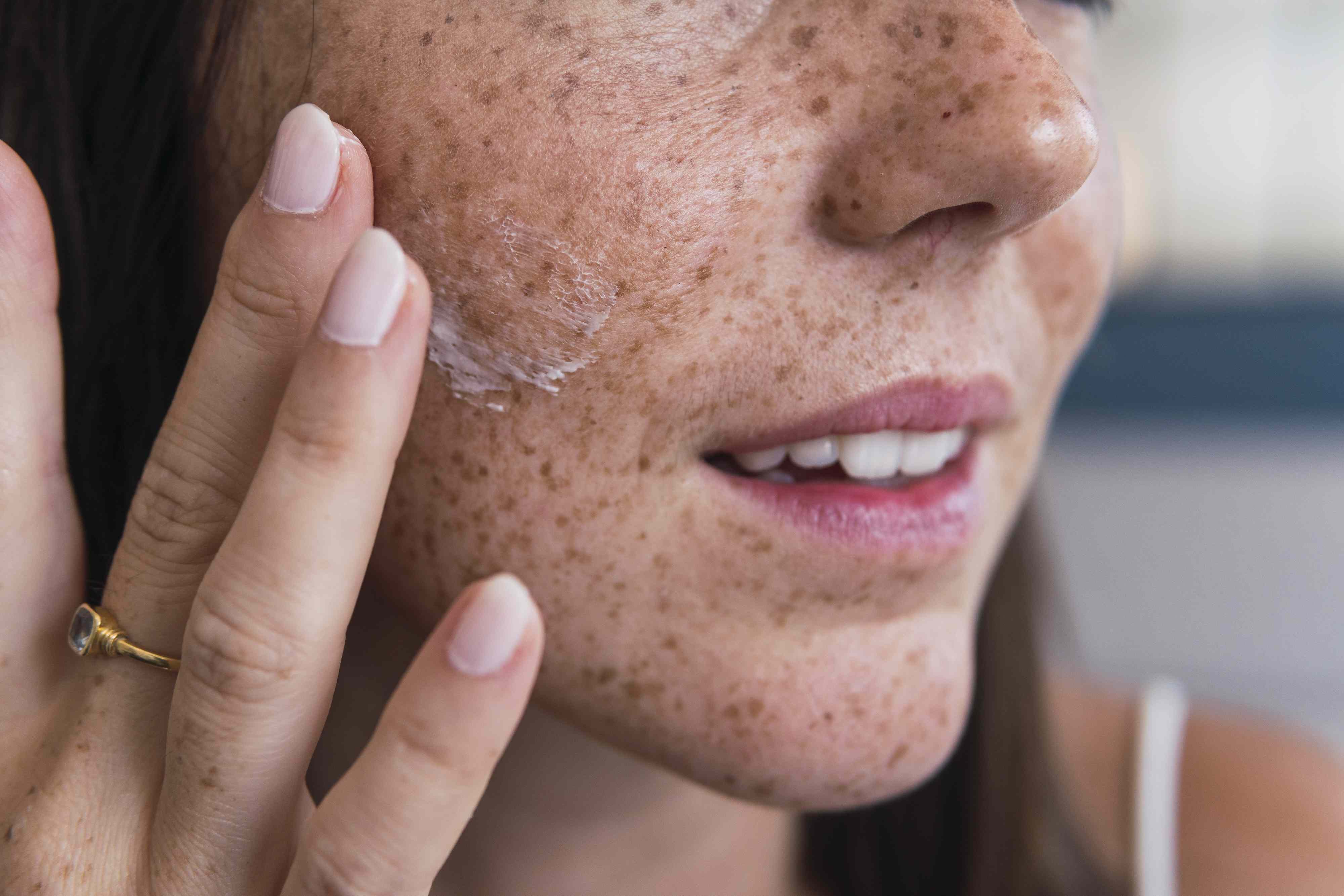 Exosomes are the biggest skin care trend of the year—but are they worth ...
