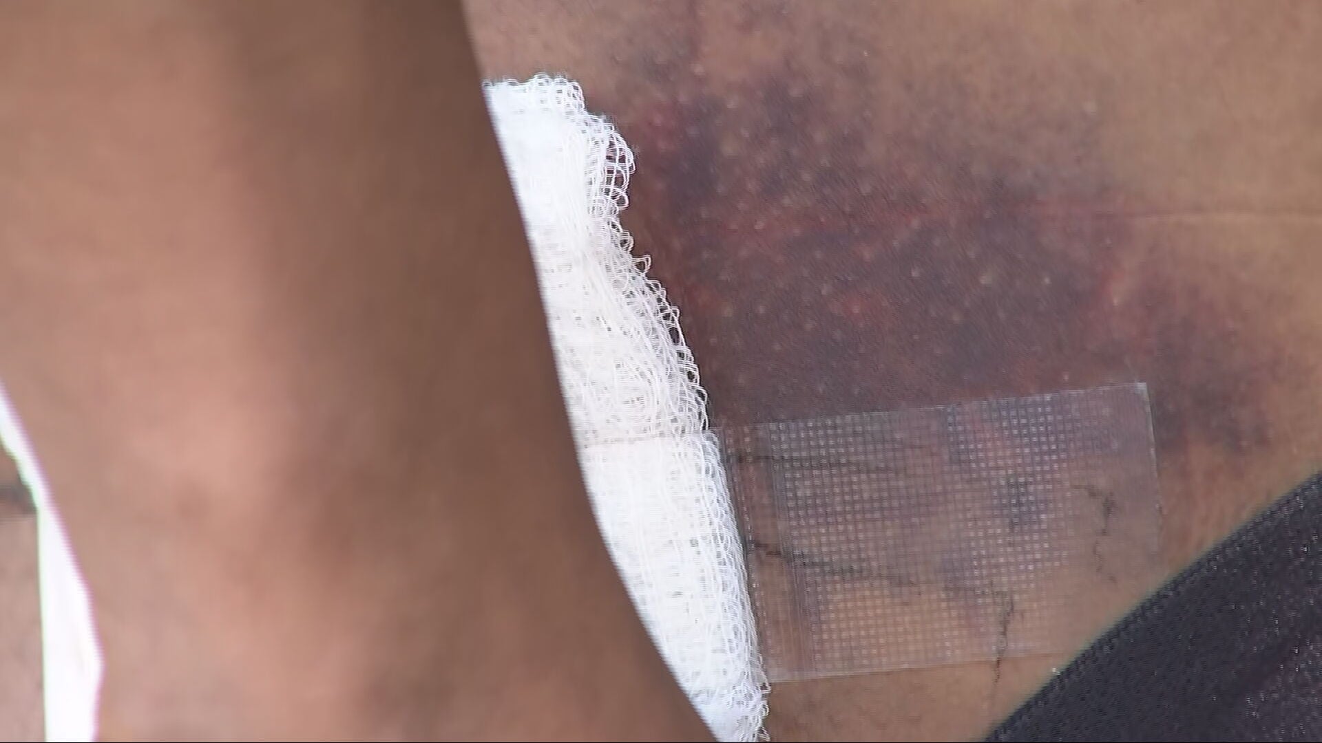 ‘I saw everything happen': Bite of Seattle shooting survivor still has bullet lodged in body