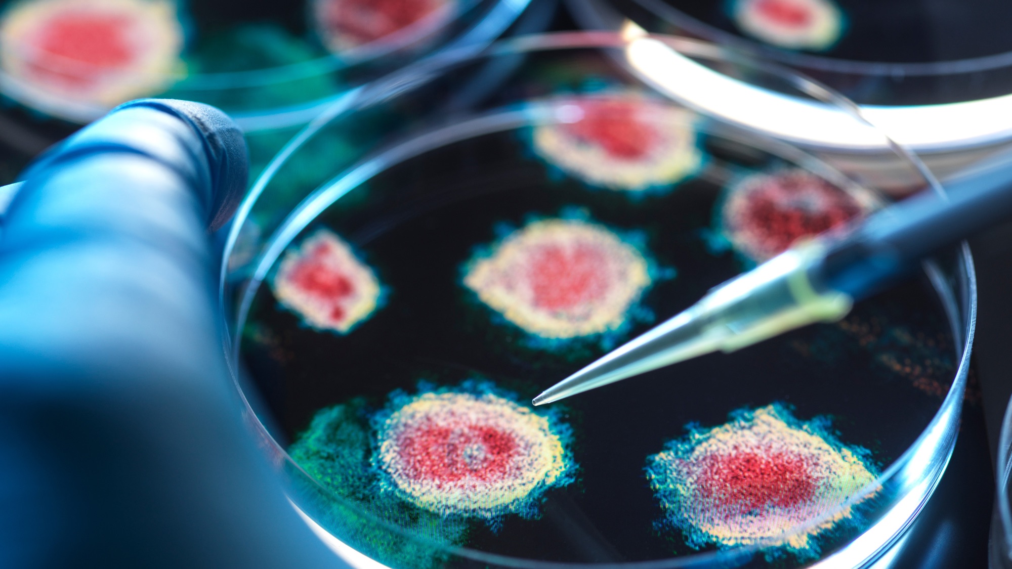 A college lab mix-up left over 30 people thinking they were exposed to ...