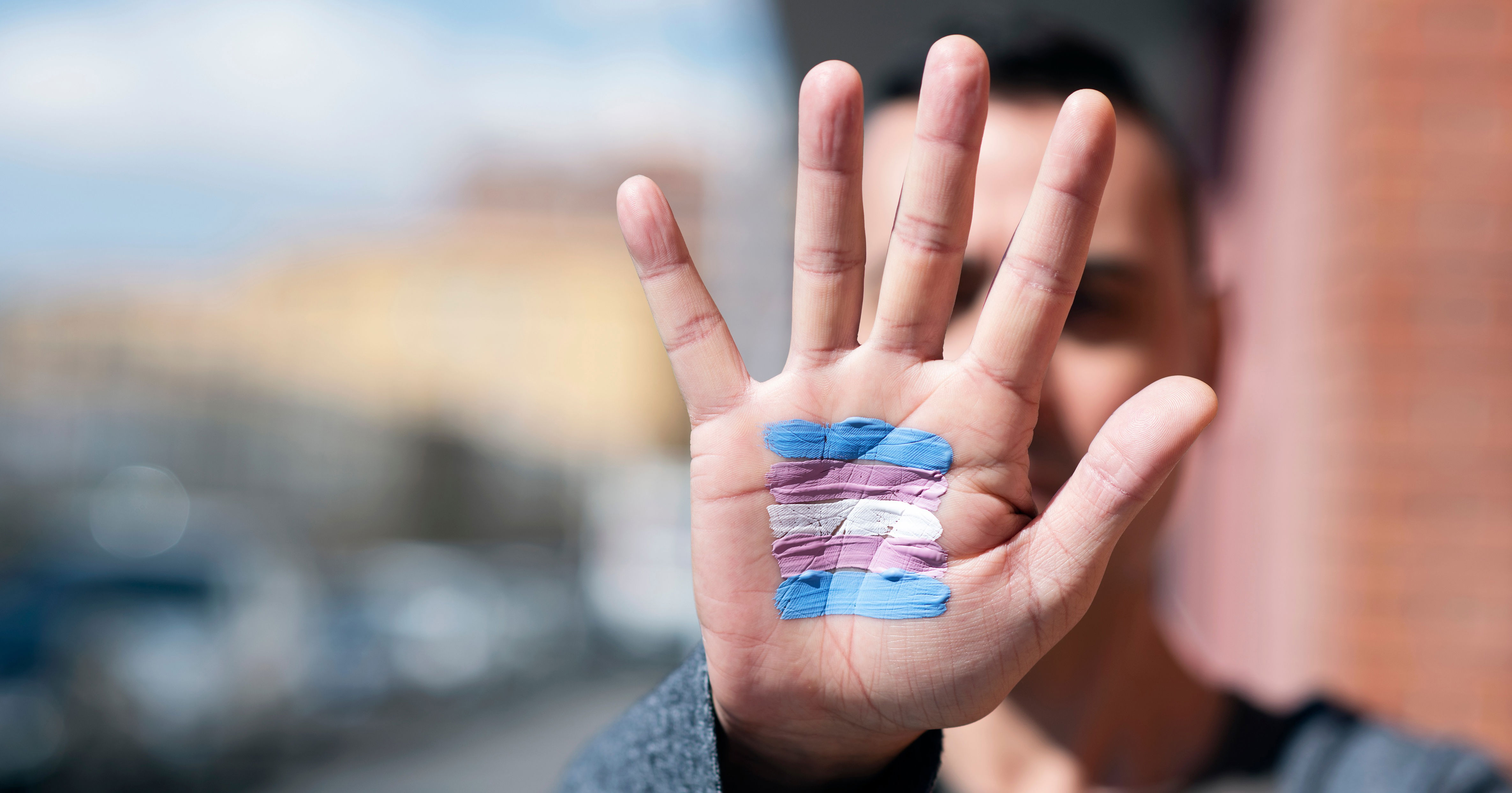 CA-based trans org see erosion of support, spurred by federal shift