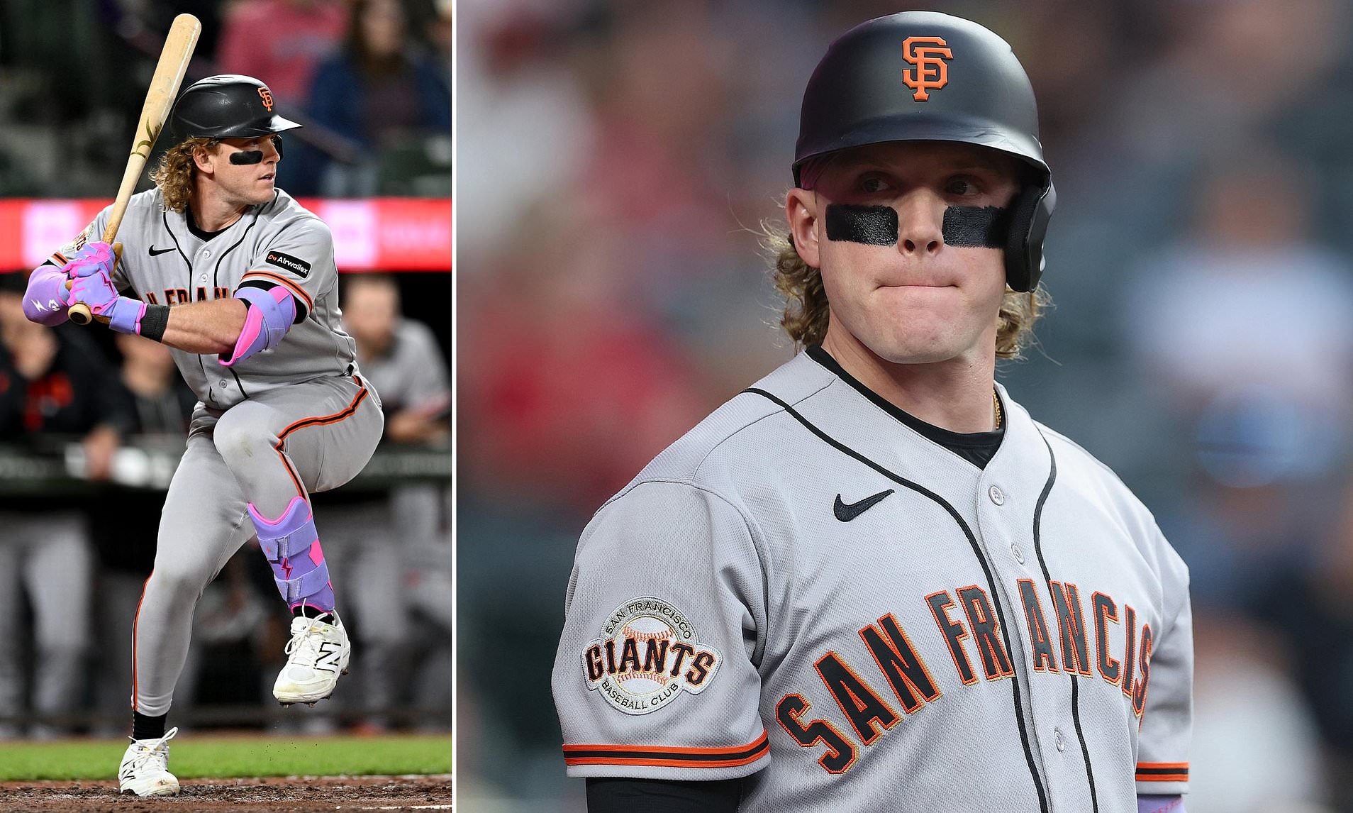 MLB star out for the season after crashing scooter into firetruck that ran over his foot