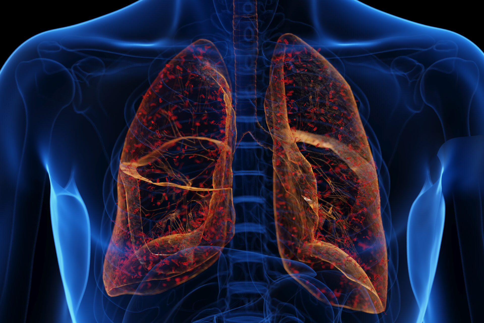 Mysterous plague outbreak hits Russia