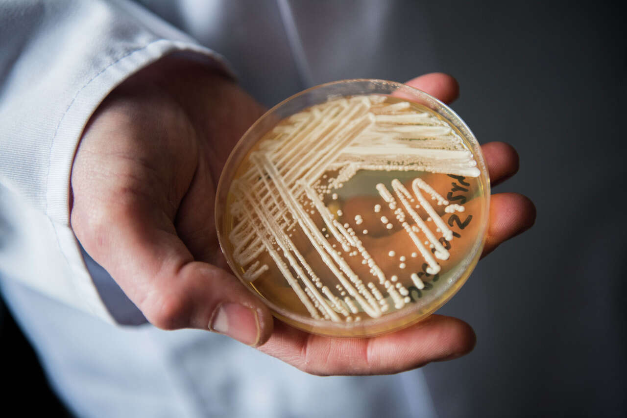 texas-a-hot-bed-as-deadly-fungus-cases-surge-in-america-what-to-know