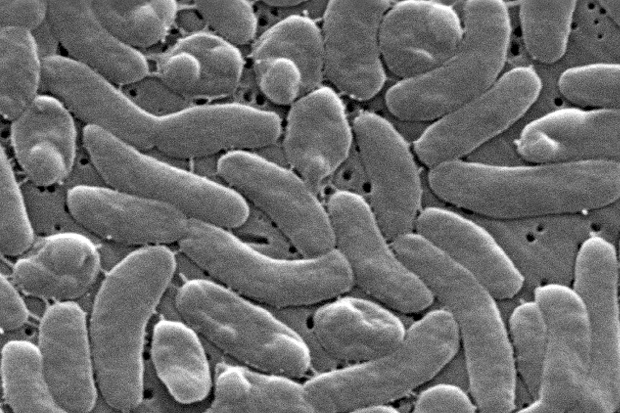 Deadly 'flesh-eating' bacteria kills 6 as alerts issued in multiple states