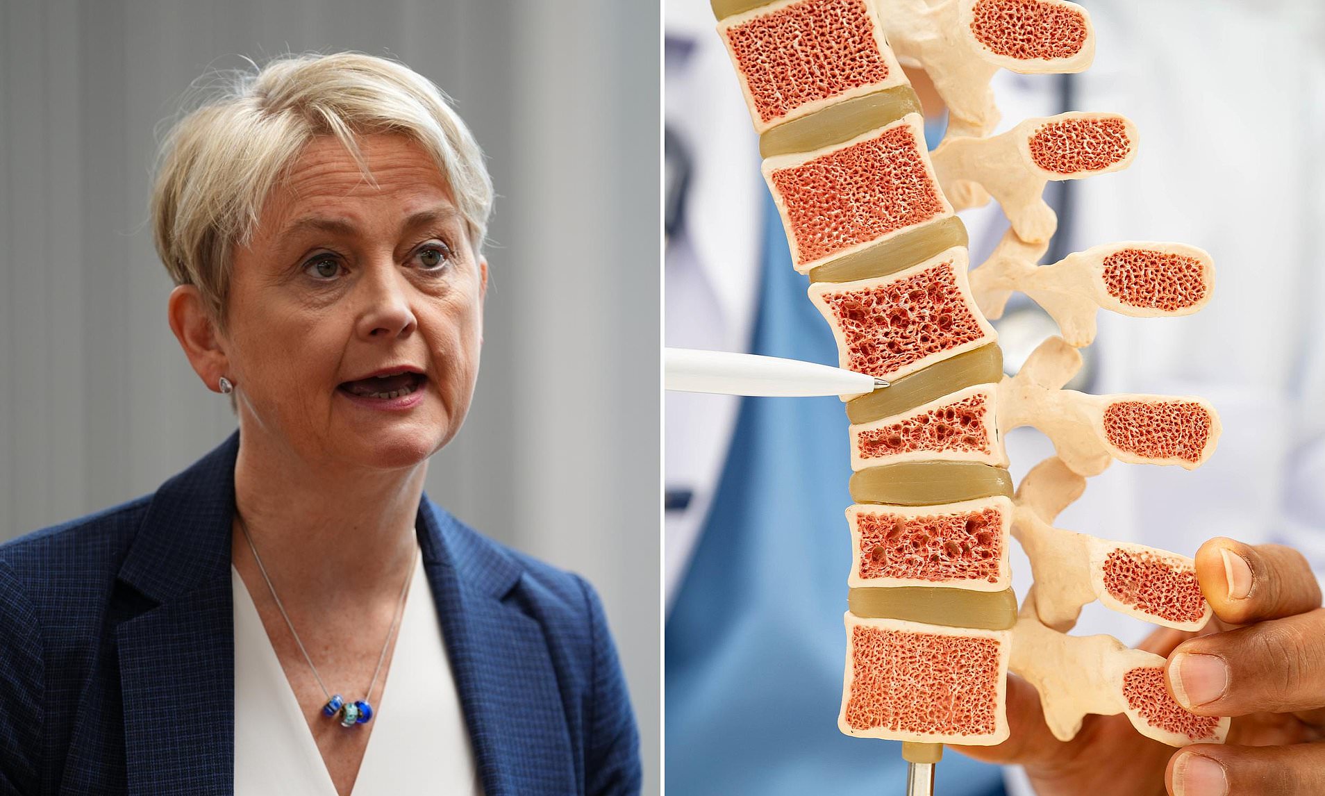 Anger at failure to roll out fracture clinics in England after Wales did so with 'little investment'