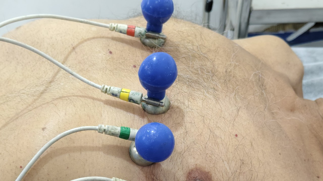 Hackers took heart patients’ birth dates and insurance numbers from Zio ...