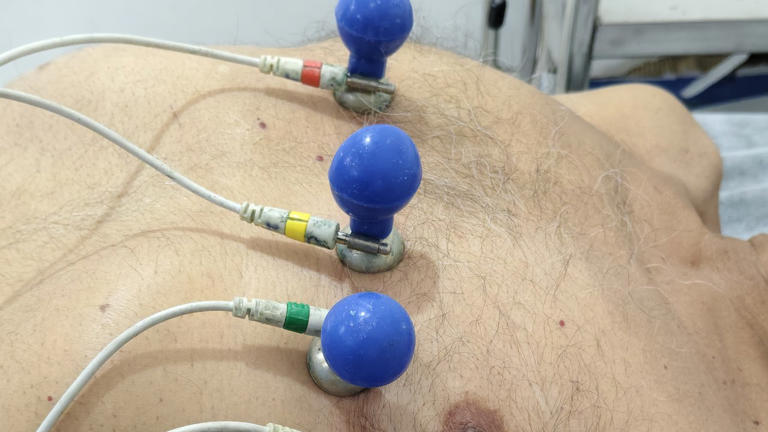 Hackers took heart patients’ birth dates and insurance numbers from Zio ...