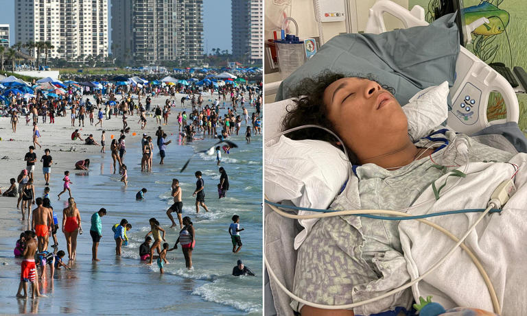 Officials issue urgent warnings to beachgoers as deaths from flesh ...