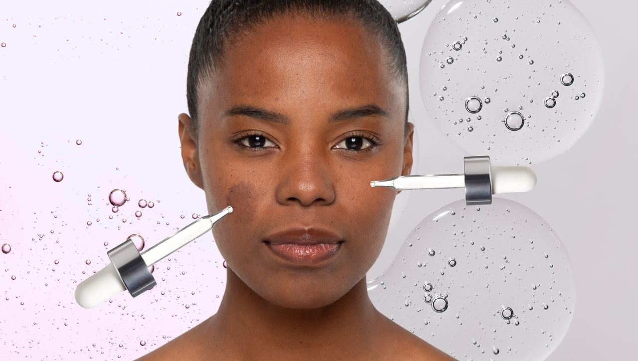 Azelaic acid vs. niacinamide: Dermatologists explain the differences for dark spots