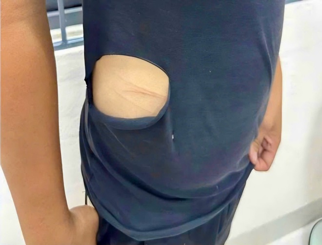 Tự làm bị thương, xé rách áo rồi báo tin giả bị cướp 40 triệu đồng, thanh niên bị xử phạt