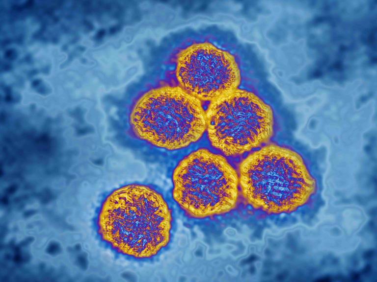 Outbreak sparks Aussie travel warning