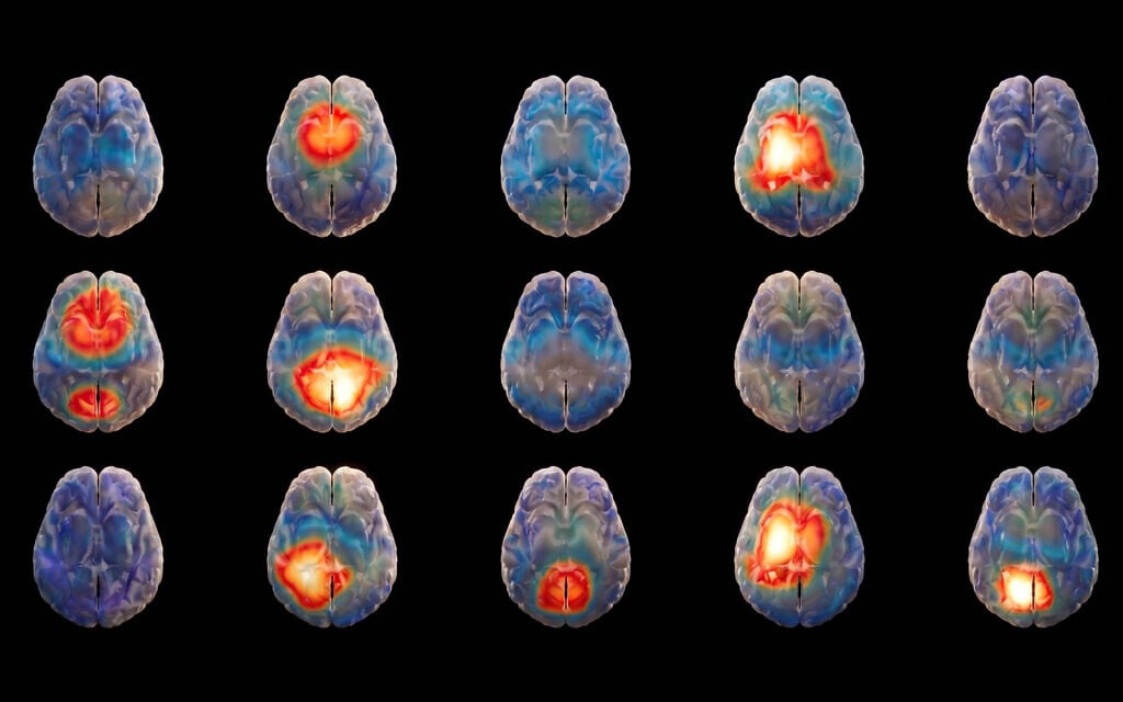 Israeli startup looks to harness AI to decode the 'language' of the brain