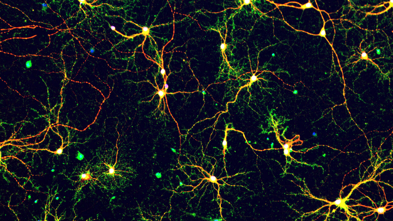 Atomic view of Alzheimer's disease peptide could inform new drugs